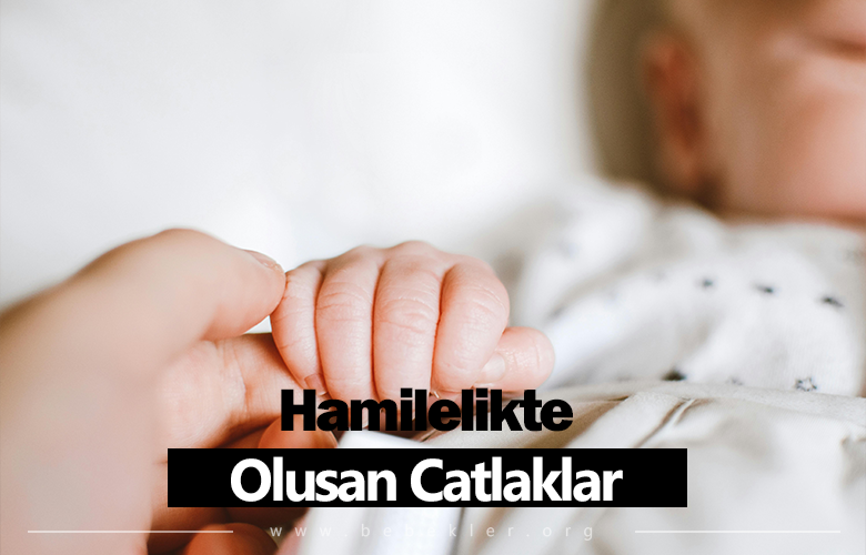 Hamilelik Döneminde Oluşan Çatlaklardan Nasıl Kurtulursunuz?